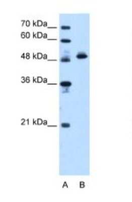 Western Blot: ATPB Antibody [NBP1-54700]