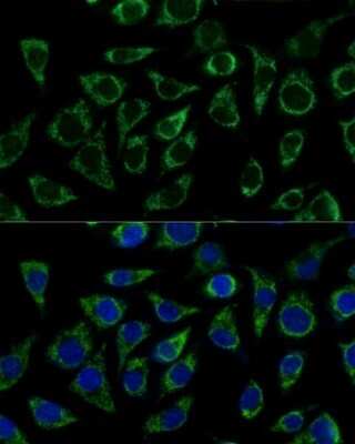 Immunocytochemistry/ Immunofluorescence: ATPG Antibody - Azide and BSA Free [NBP2-92867]