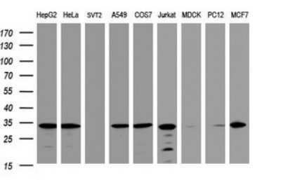 Western Blot: ATPG Antibody (OTI2H6)Azide and BSA Free [NBP2-70233]