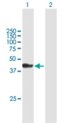 Western Blot: ATPGD1 Antibody [H00057571-B01P]