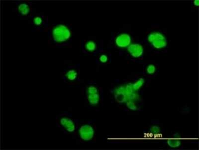 Immunocytochemistry/ Immunofluorescence: ATPase Inhibitory Factor 1 Antibody (3E2) [H00093974-M01]