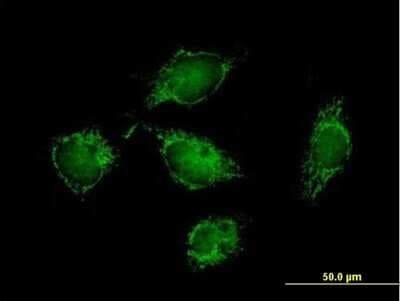 Immunocytochemistry/ Immunofluorescence: ATPase Inhibitory Factor 1 Antibody [H00093974-B01P]