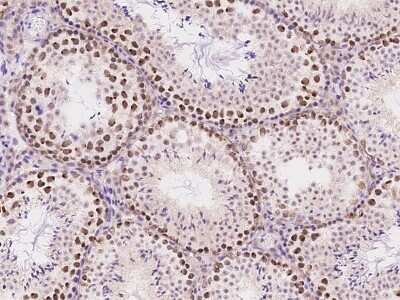 Immunohistochemistry-Paraffin: ATR Antibody [NBP2-98982]