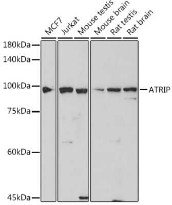 Western Blot: ATRIP Antibody (2C4B6) [NBP3-15738]