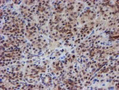 Immunohistochemistry-Paraffin: ATRIP Antibody (OTI5E7) [NBP2-02004]
