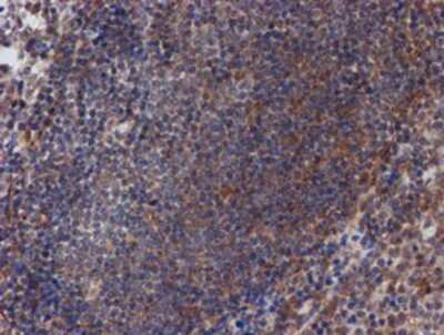 Immunohistochemistry-Paraffin: ATRIP Antibody (OTI5E7) [NBP2-02004]