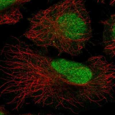 Immunocytochemistry/ Immunofluorescence: ATRIP Antibody [NBP2-55702]