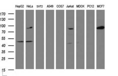 Western Blot: ATRIP Antibody (OTI1G6)Azide and BSA Free [NBP2-72270]