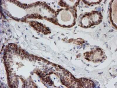 Immunohistochemistry: ATRIP Antibody (OTI5E7) - Azide and BSA Free [NBP2-72271]