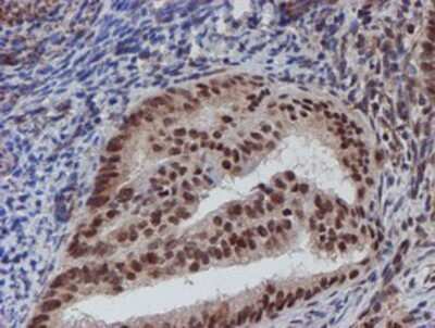 Immunohistochemistry: ATRIP Antibody (OTI5E7) - Azide and BSA Free [NBP2-72271]