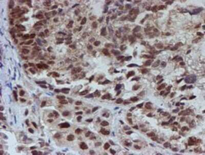 Immunohistochemistry: ATRIP Antibody (OTI5E7) - Azide and BSA Free [NBP2-72271]