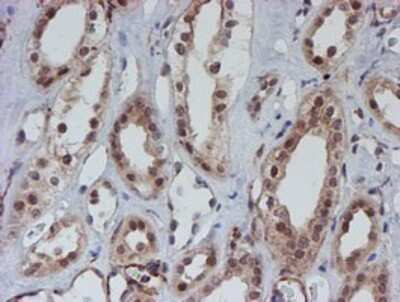 Immunohistochemistry: ATRIP Antibody (OTI5E7) - Azide and BSA Free [NBP2-72271]