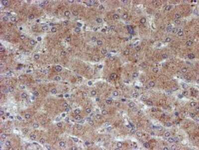 Immunohistochemistry: ATRIP Antibody (OTI5E7) - Azide and BSA Free [NBP2-72271]