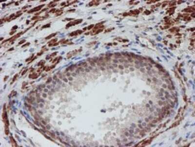 Immunohistochemistry: ATRIP Antibody (OTI5E7) - Azide and BSA Free [NBP2-72271]