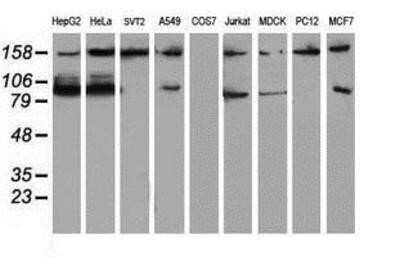 Western Blot: ATRIP Antibody (OTI5E7)Azide and BSA Free [NBP2-72271]