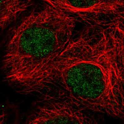 Immunocytochemistry/ Immunofluorescence: ATRX Antibody (CL0537) [NBP2-52938]