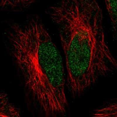Immunocytochemistry/ Immunofluorescence: ATRX Antibody (CL0537) [NBP2-52938]