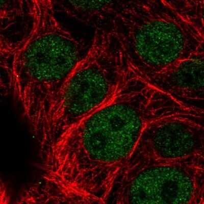 Immunocytochemistry/ Immunofluorescence: ATRX Antibody (CL0537) [NBP2-52938]