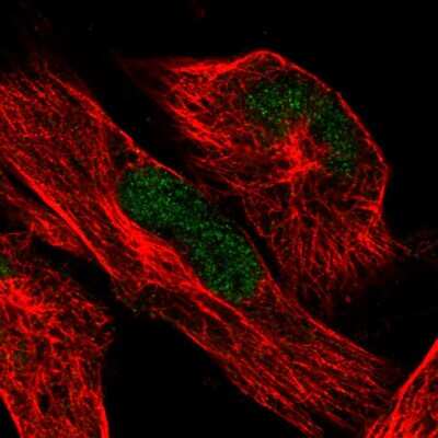 Immunocytochemistry/ Immunofluorescence: ATRX Antibody (CL0537) [NBP2-52938]