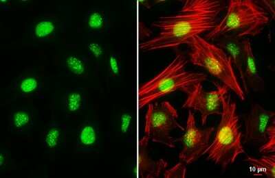 Immunocytochemistry/ Immunofluorescence: ATRX Antibody (HL1210) [NBP3-13663]