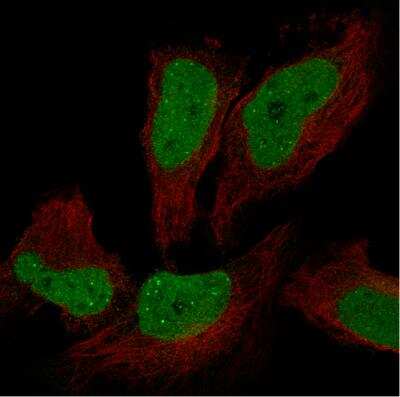 Immunocytochemistry/ Immunofluorescence: ATRX Antibody [NBP1-83077]