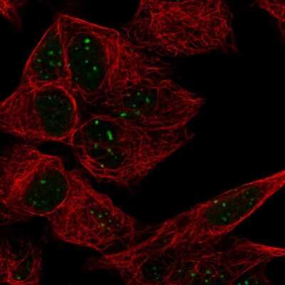 Immunocytochemistry/ Immunofluorescence: ATRX Antibody [NBP2-55953]