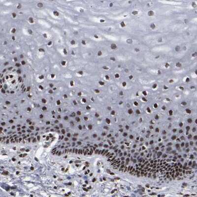 Immunohistochemistry-Paraffin: ATRX Antibody [NBP1-83077]