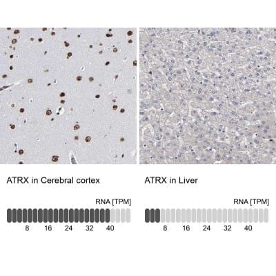 Immunohistochemistry-Paraffin: ATRX Antibody [NBP1-83077]