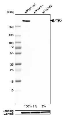 Western Blot: ATRX Antibody [NBP1-83077]