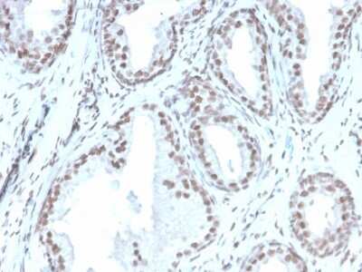 Immunohistochemistry-Paraffin: ATRX Antibody (rATRX/3446) - Azide and BSA Free [NBP3-08673]