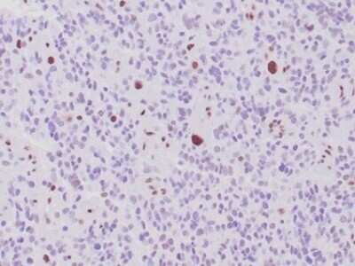 Immunohistochemistry-Paraffin: ATRX Antibody (rATRX/3446) - Azide and BSA Free [NBP3-08673]