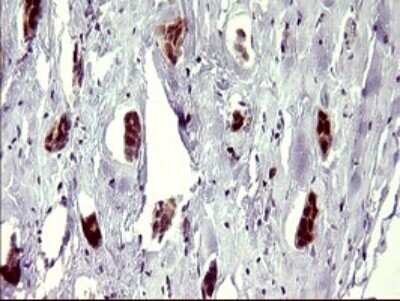 Immunohistochemistry: ATXN7L1 Antibody (OTI4F6) [NBP2-46558]