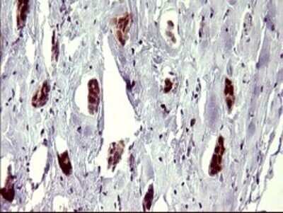 Immunohistochemistry: ATXN7L1 Antibody (OTI4F6) - Azide and BSA Free [NBP2-72464]