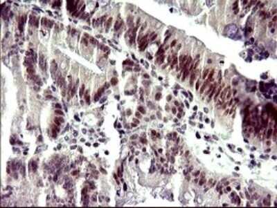 Immunohistochemistry: ATXN7L1 Antibody (OTI4F6) - Azide and BSA Free [NBP2-72464]