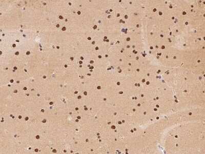 Immunohistochemistry-Paraffin: ATXN7L2 Antibody [NBP2-98179]