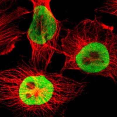 Immunocytochemistry/ Immunofluorescence: AUF1 Antibody [NBP1-88915]