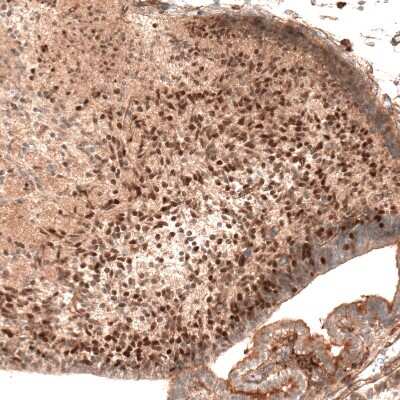 Immunohistochemistry-Paraffin: AUTS2 Antibody (CL7067) [NBP2-76529]