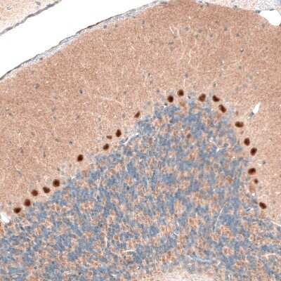 Immunohistochemistry-Paraffin: AUTS2 Antibody (CL7067) [NBP2-76529]