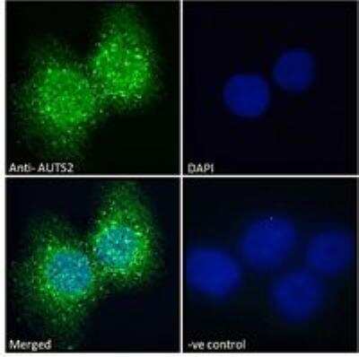 Immunocytochemistry/ Immunofluorescence: AUTS2 Antibody [NBP3-05291]