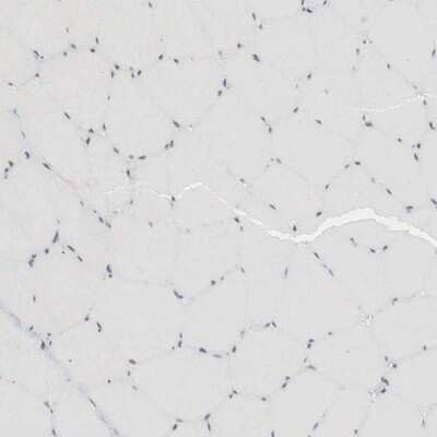 Immunohistochemistry-Paraffin: AUTS2 Antibody [NBP1-84717]