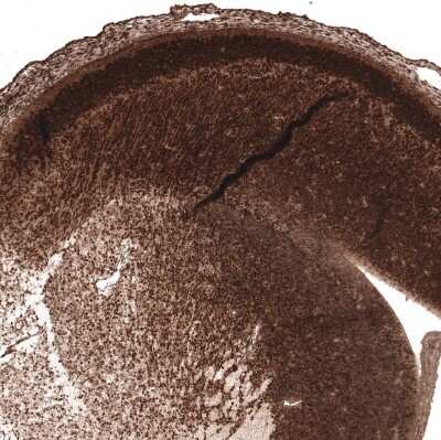Immunohistochemistry-Paraffin: AUTS2 Antibody [NBP1-84717]