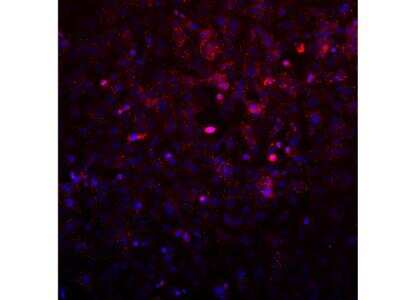 Immunocytochemistry/ Immunofluorescence: AVL9 Antibody [NBP2-14337]