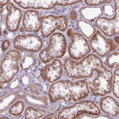 Immunohistochemistry-Paraffin: AVL9 Antibody [NBP2-14337]