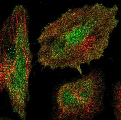 Immunocytochemistry/ Immunofluorescence: AVPI1 Antibody [NBP1-80888]