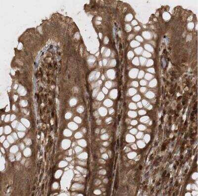 Immunohistochemistry-Paraffin: AVPI1 Antibody [NBP1-80888]