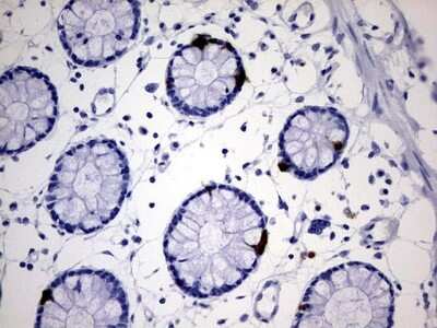 Immunohistochemistry: AVPI1 Antibody (OTI1G1) - Azide and BSA Free [NBP2-72121]
