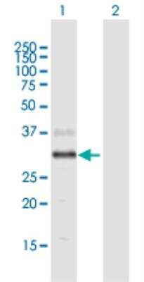 Western Blot: AWAT2 Antibody [H00158835-B01P-50ug]