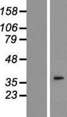 Western Blot: AWAT2 Overexpression Lysate [NBP2-08948]