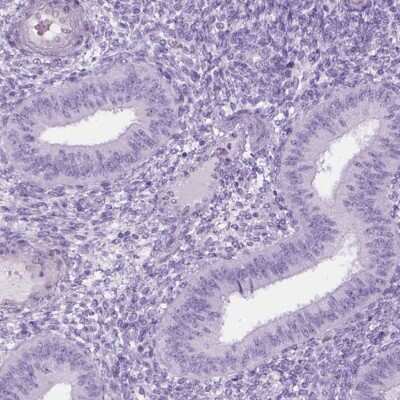 Immunohistochemistry-Paraffin: AXDND1 Antibody [NBP2-49645]