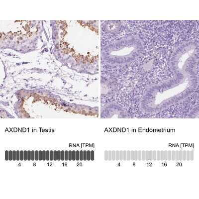 Immunohistochemistry-Paraffin: AXDND1 Antibody [NBP2-49645]